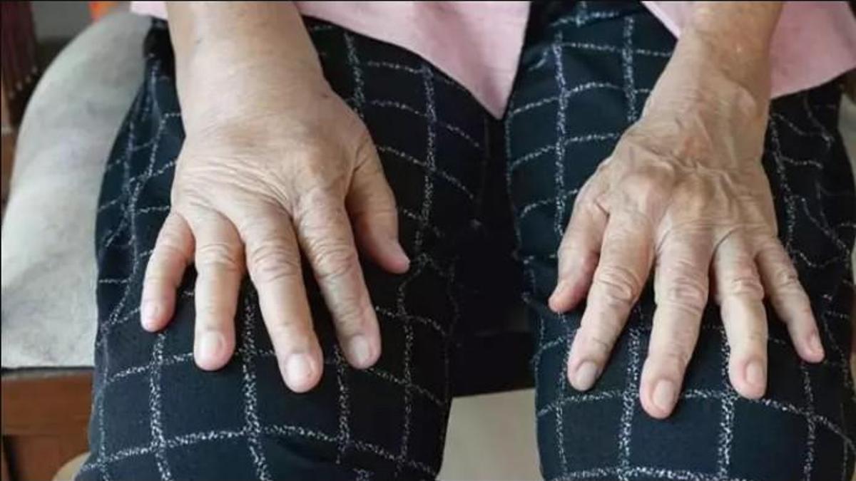 Kadınların dikkatine: Bu hastalığın erken teşhisi yaşam kalitesini artırıyor